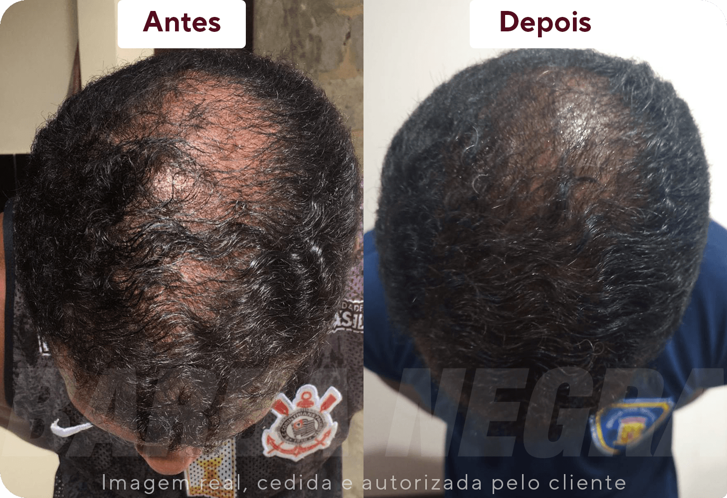 Resltados Cabelo 1