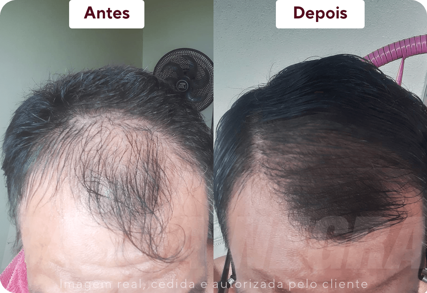 Resltados Cabelo 2
