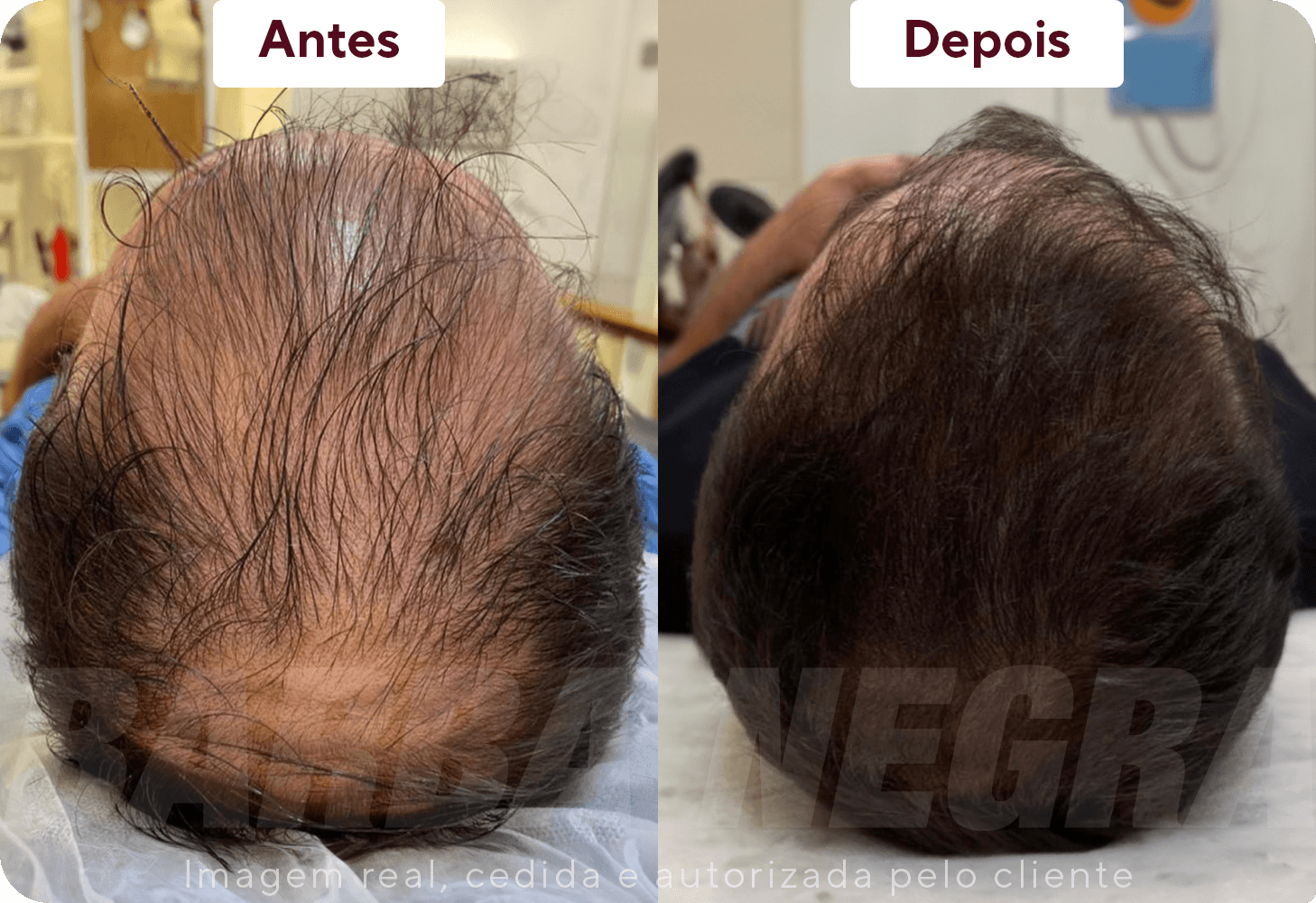 Resltados Cabelo 3