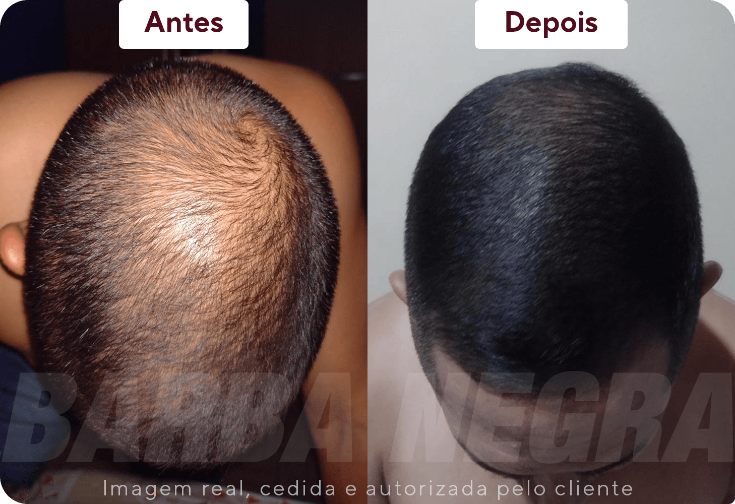 Resltados Cabelo 4