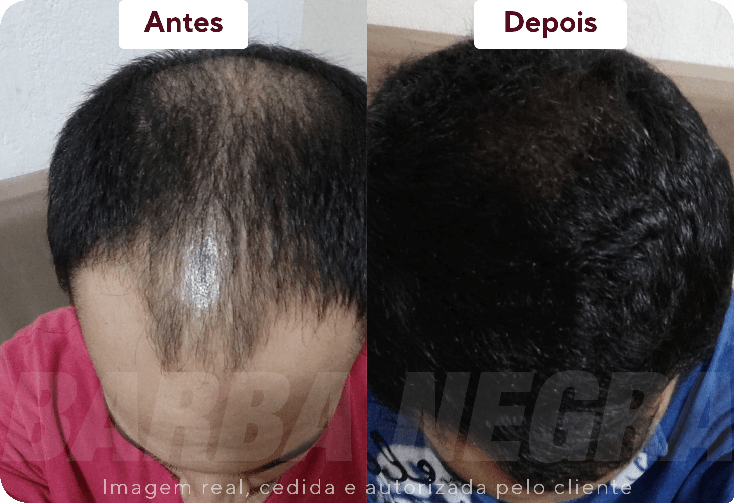 Resltados Cabelo 5