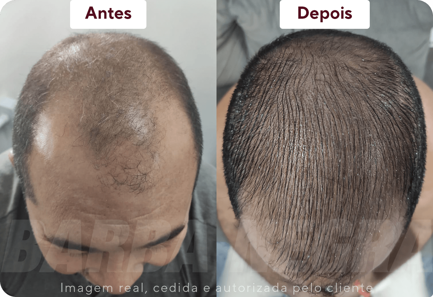 Resltados Cabelo 6