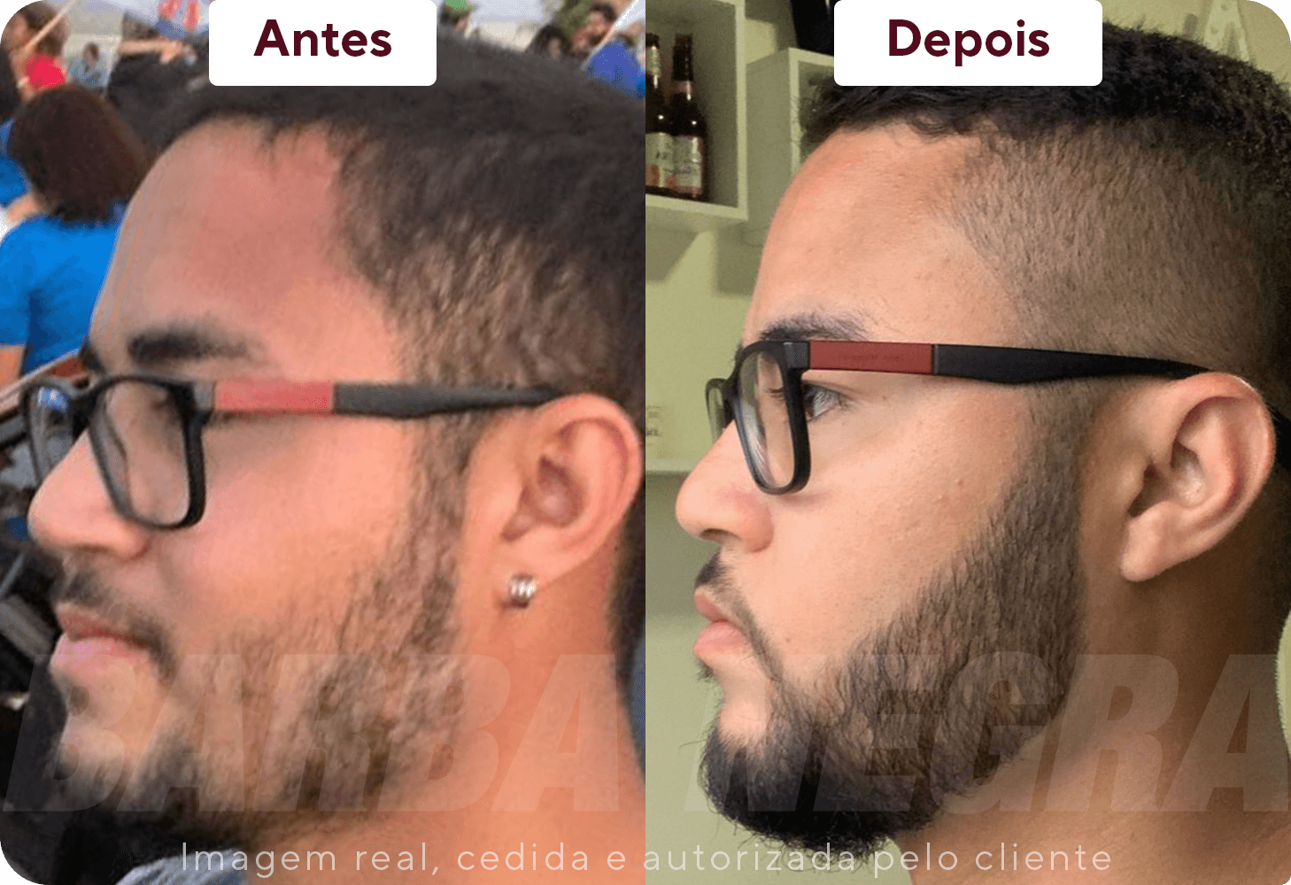 Resultados Barba 1