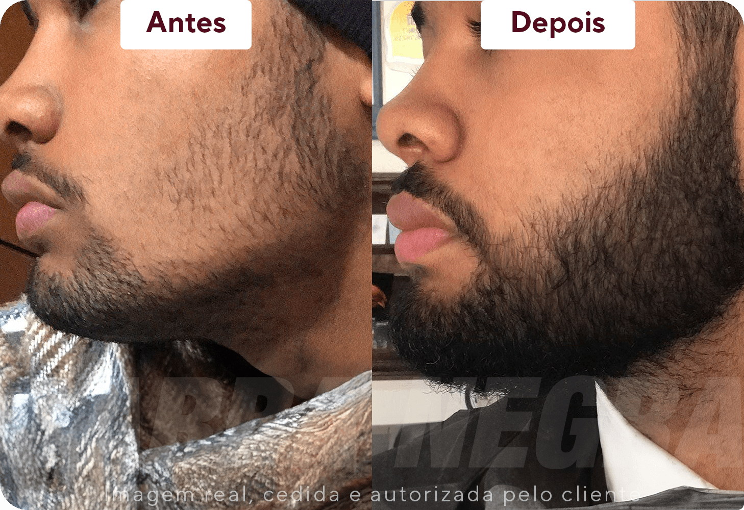 Resultados Barba 2