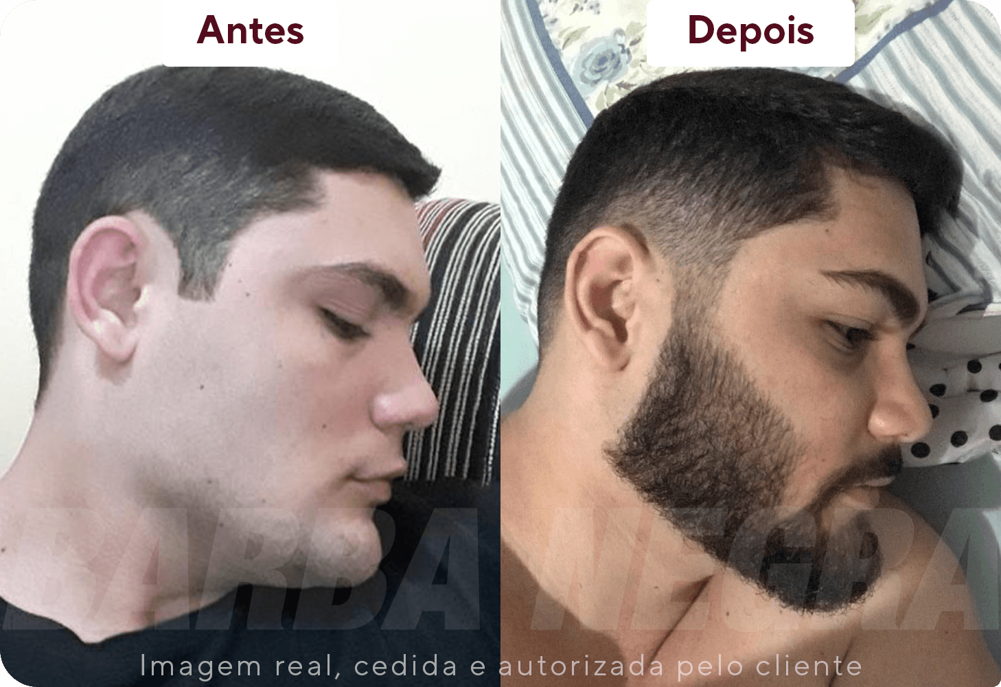 Resultados Barba 4