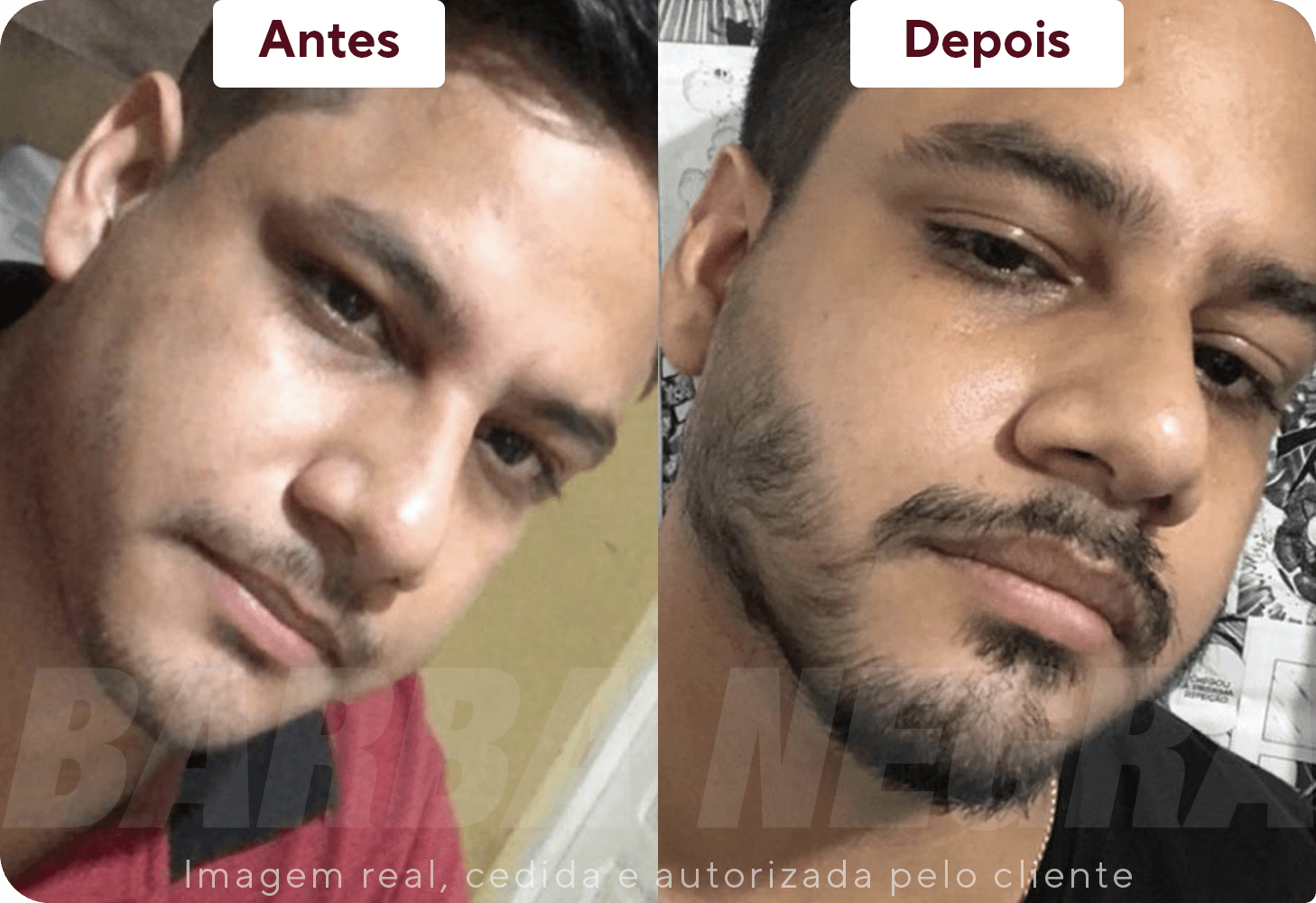 Resultados Barba 5