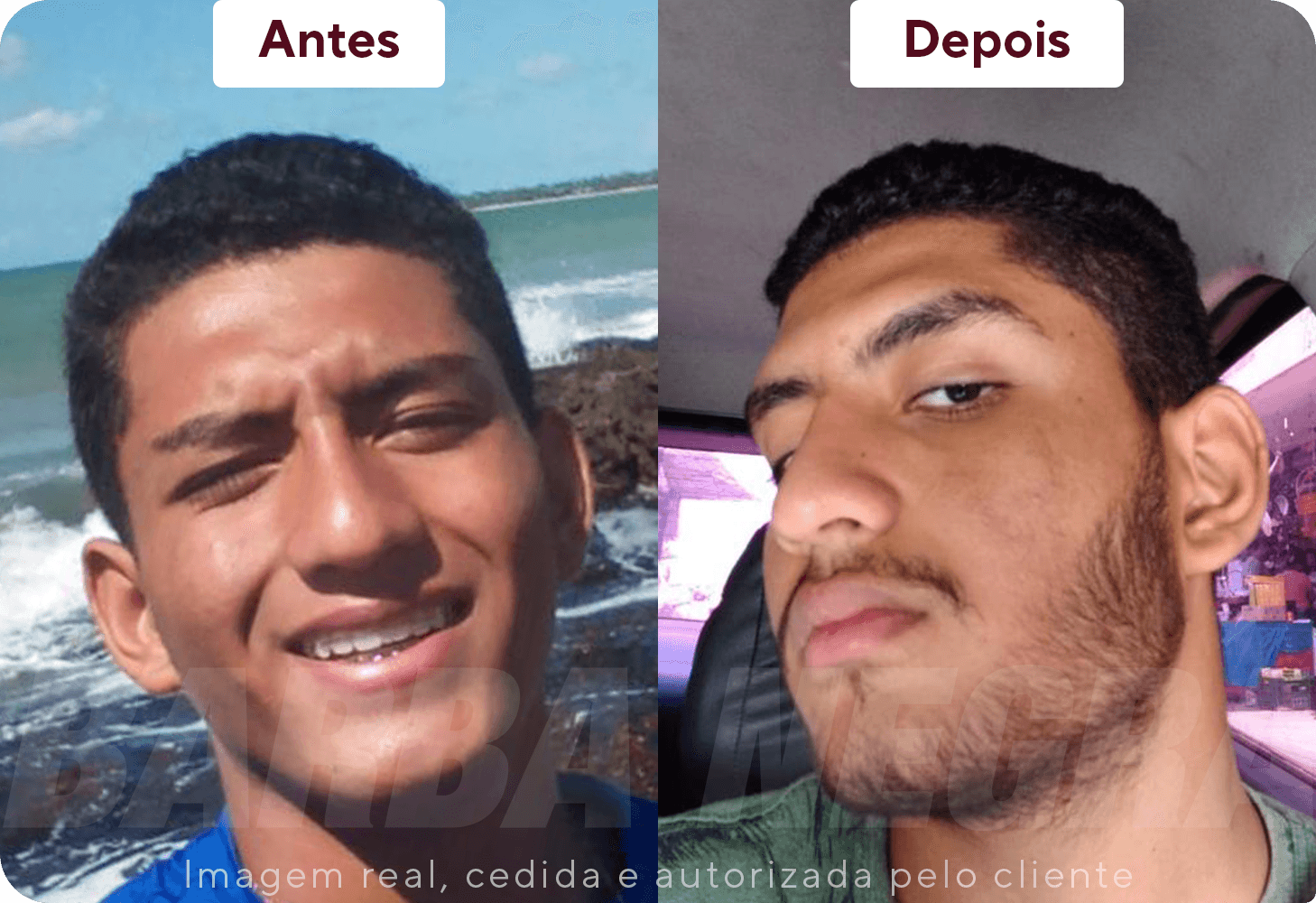 Resultados Barba 6